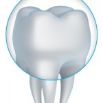 Photo of a porcelain crown that is placed on top of dental implants by the Parker dentists of Almeida & Bell Dental.
