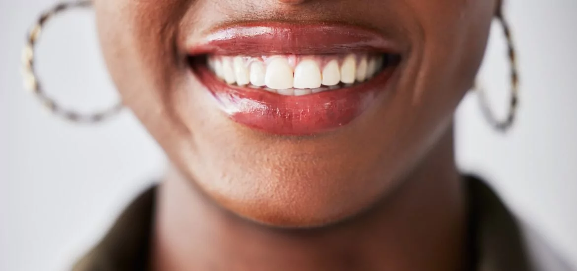 closeup of a beautiful white smile