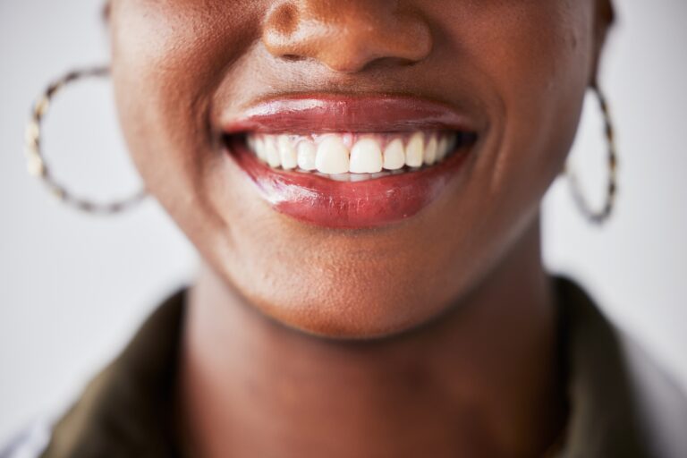 closeup of a beautiful white smile