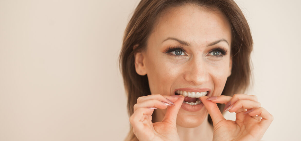 smiling woman putting in her clear aligners, beige background