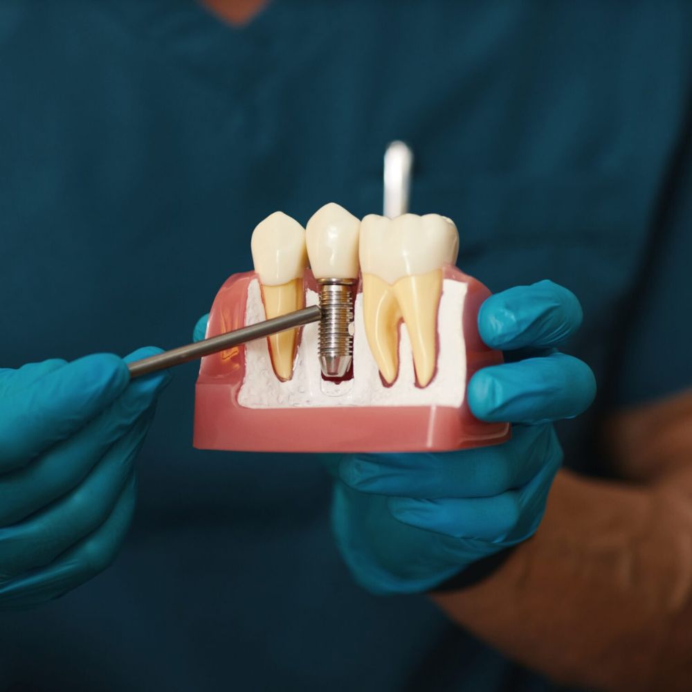 lone tree denver dentist giving patient a free dental implant consultation