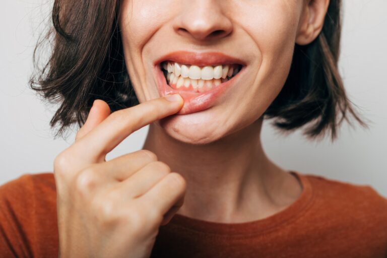 closeup shot of a woman with minor gum recession