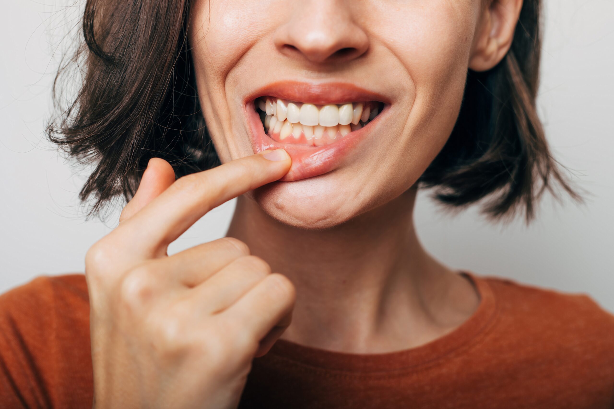 closeup shot of a woman with minor gum recession