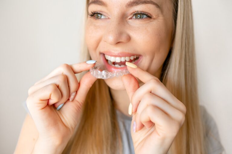 closeup of a young woman putting in clear aligners
